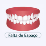 Falta de Espaço