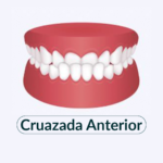cruazada anterior